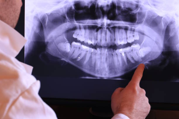 Best Urgent Tooth Repair  in Brier, WA