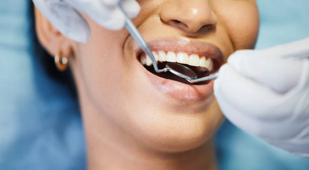 Best Dentist for Severe Toothache  in Brier, WA
