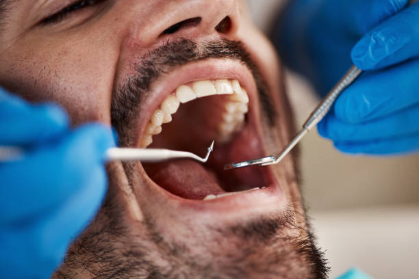 Best Broken Tooth Emergency  in Brier, WA