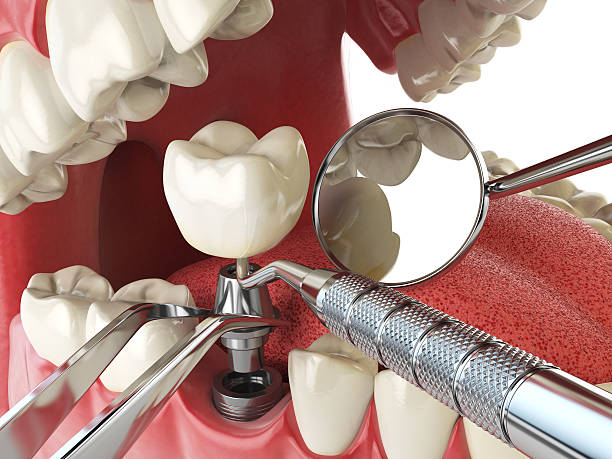 Best Emergency Gum Pain Relief  in Brier, WA