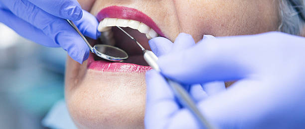 Best Chipped Tooth Repair Near Me  in Brier, WA